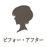 ビフォー・アフター